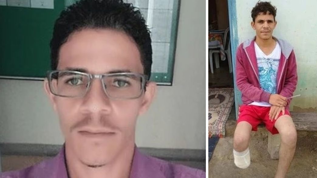 ונדרלי דוס סנטוס גומס: כרת רגל בשביל הביטוח ונפל על שטות אחת