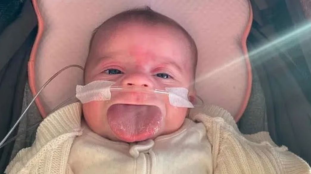 לולו ליטל: למה הלשון שלה ממשיכה לגדול ואיך זה קשור לניתוח הקרוב