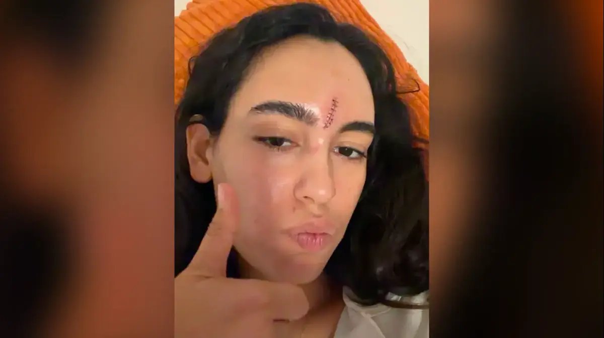 נועם קליינשטיין התעלפה ונחבלה בראשה: מה שקרה ליד האמפי בשוני לא ציפיתם